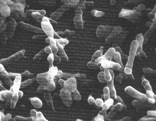 细胞培养中的污染预防措施,细胞培养过程中的支原体污染图片