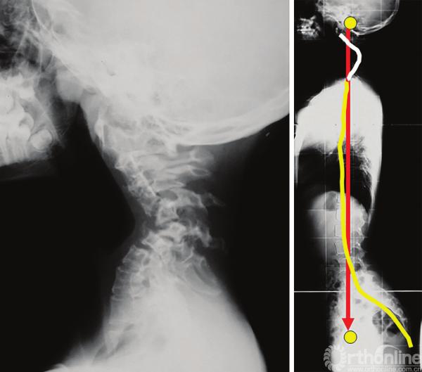 人体平衡分析,健身气功脊柱平衡整套教学视频