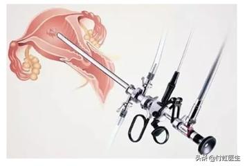 b超检查内膜回声不均是怎么回事,b超子宫内膜回声不均是怎么回事