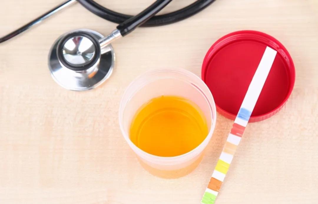 高尿酸能彻底治愈吗,痛风脚疼的最快缓解方法