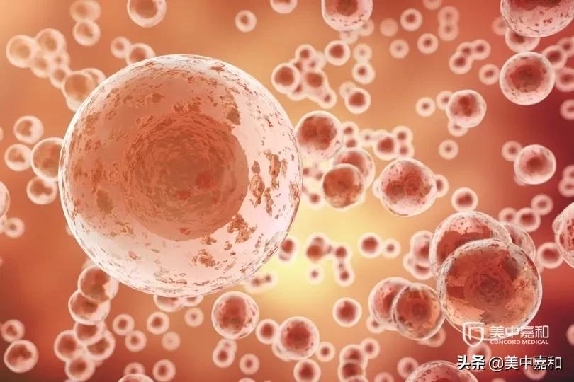 化疗到底是救人还是杀人,化疗是救还是害人