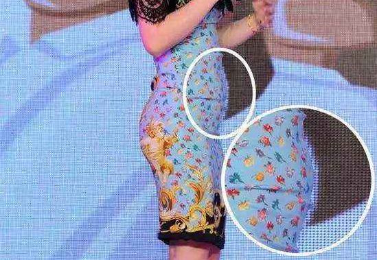 有些人看起来很正常其实有病,体型前凸后凸怎么改善