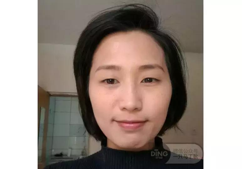 中庭又长又宽显老,中庭长怎么避免显老