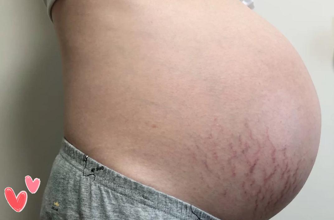 37周孕晚期突然胎动频繁怎么回事,孕晚期胎动频繁是咋回事