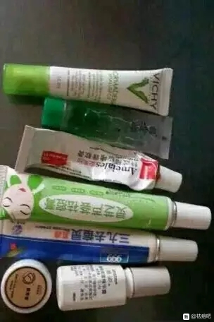 祛痘治疗后恢复,祛痘可以治好痘痘吗