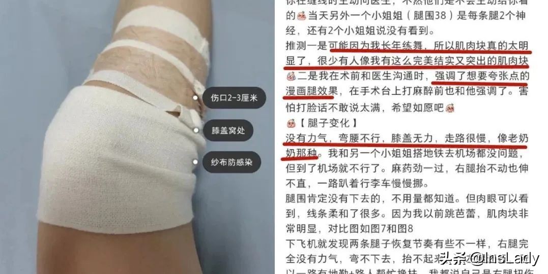 整容毁掉容貌的女子,一名女子整容却毁了她一生