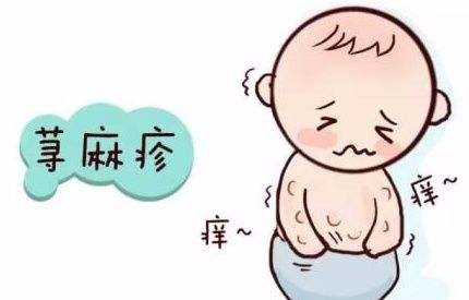 拔罐治疗疾病的方法,拔罐治疗病症及穴位