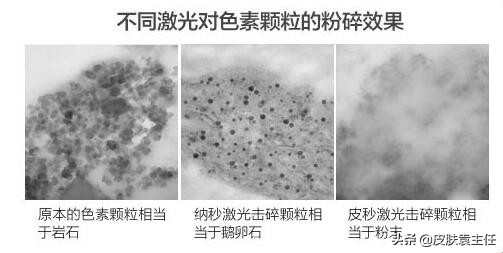 遮瑕遮不住雀斑怎么办,什么样的遮瑕可以遮掉雀斑