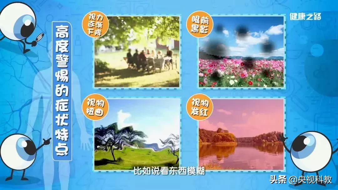 眼底照相全过程,拍一张眼睛的照片