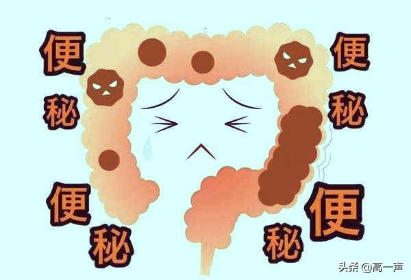 便秘的4种治疗方法建议收藏,3个方法治疗便秘欢迎收藏