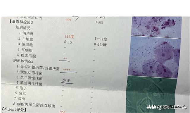 17岁女生，为了抗病毒一次性*裤内**每天换，遭到医生吓止：没必要