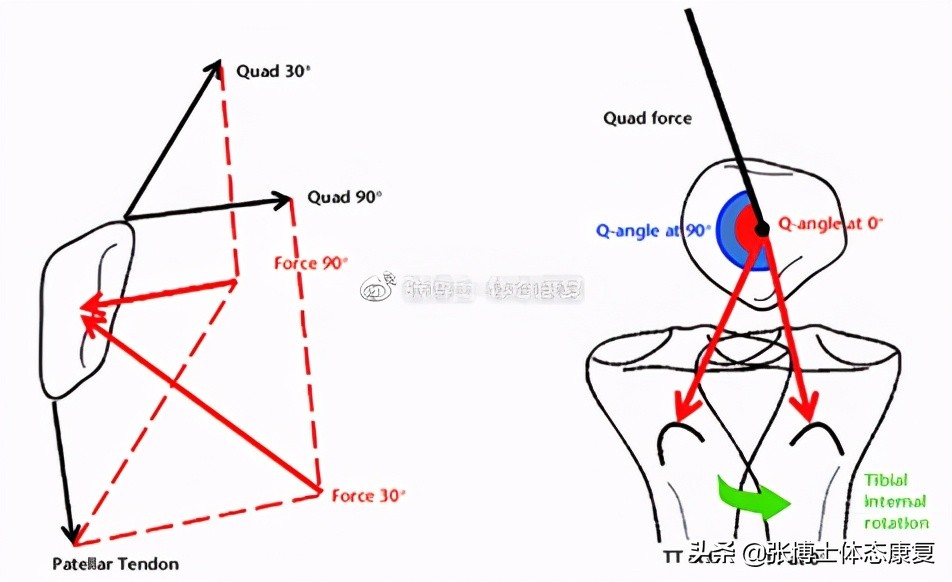 运动康复膝关节疼痛解决,下髌骨关节疼痛综合征
