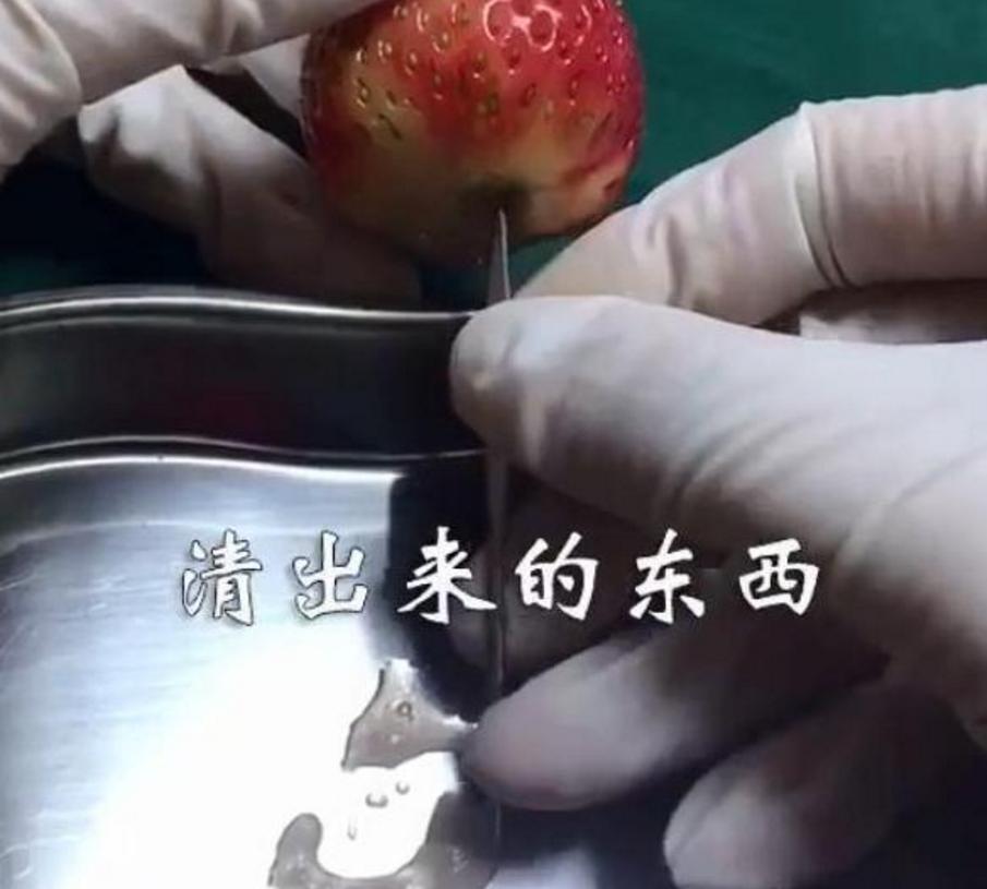 “引产”过程多残忍？清楚感受从有到无，孕妈：有心跳后别打掉他