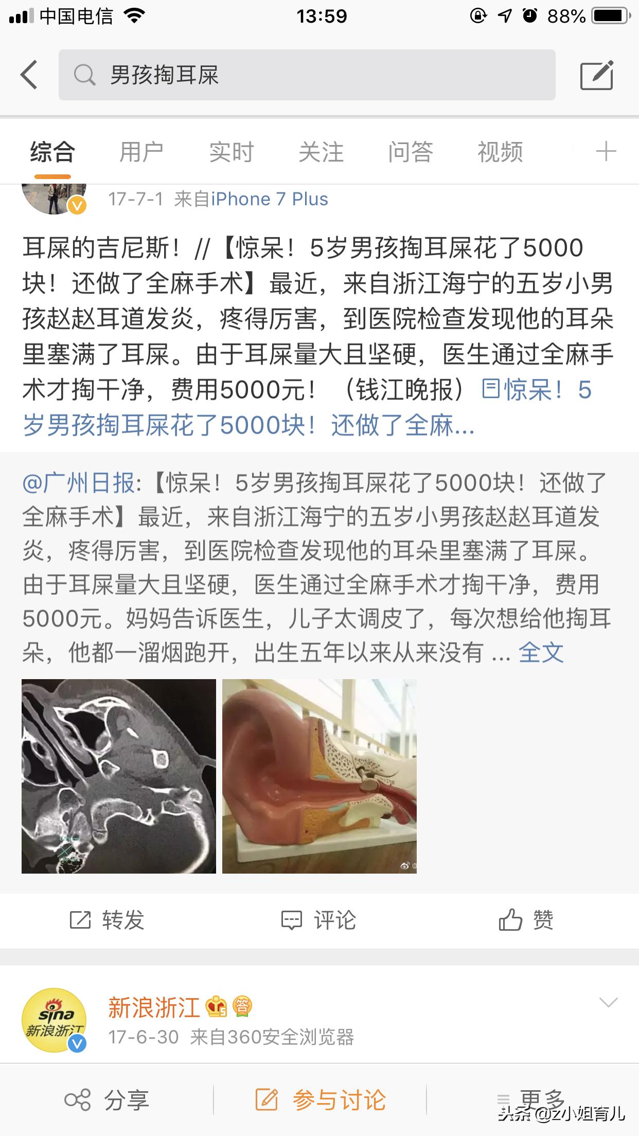 家长可以给小孩挖耳朵吗,宝宝耳朵能挖耳屎吗