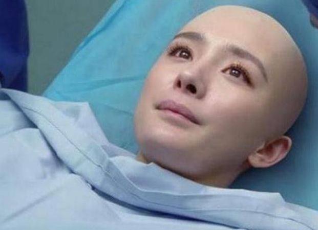 女演员拍戏光头剧照真剃发吗,女明星为了拍戏剃光头