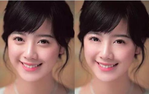 中庭太长显老,中庭过长会怎样