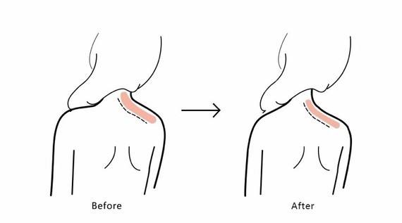 25岁了脖子还能长长吗,25岁脖子上长了两条深纹