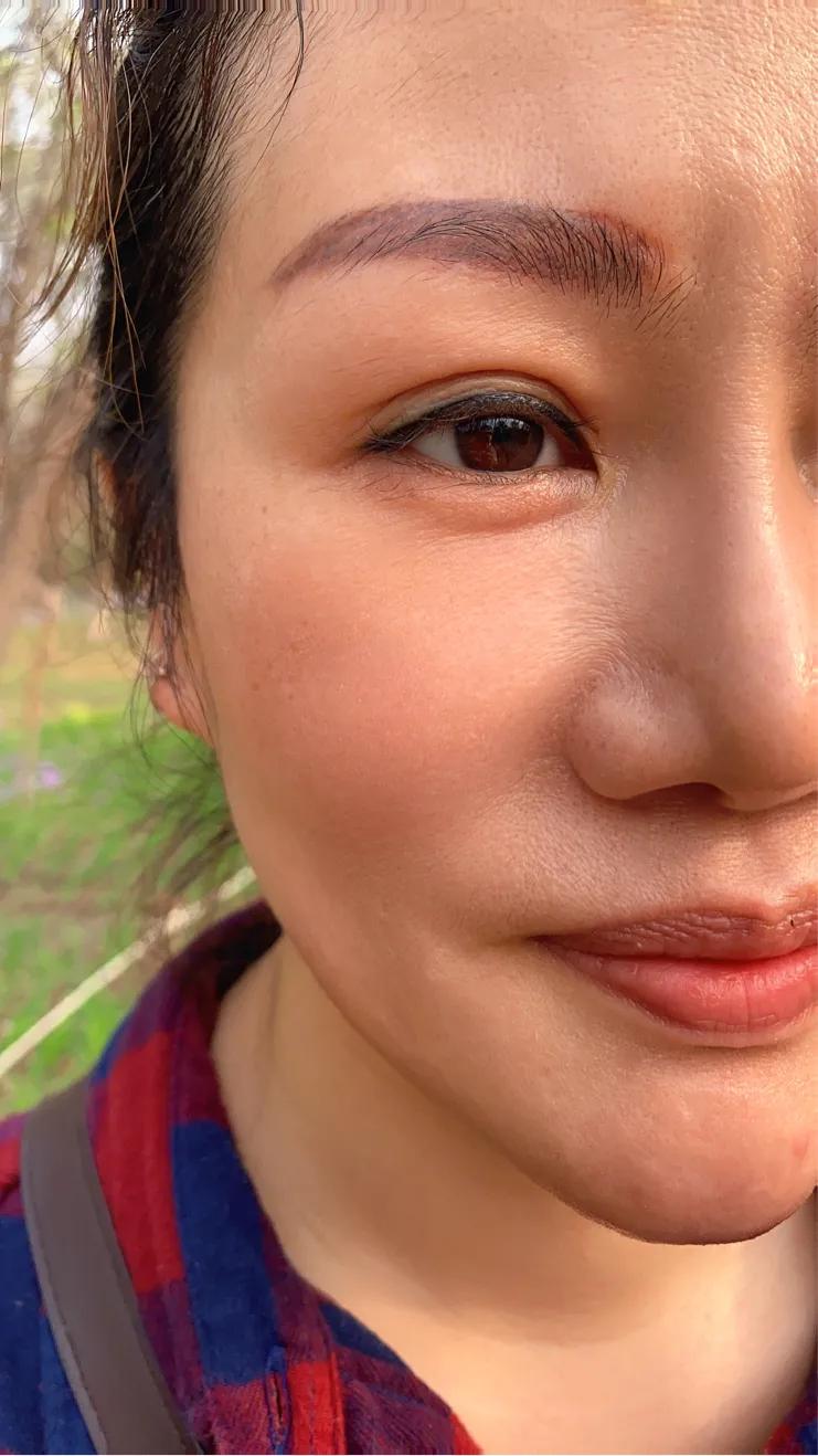 皮肤衰老了，长了印第安纹怎么办？