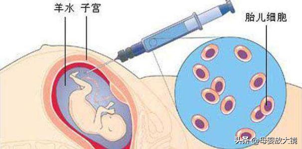 孕期产检:B超,唐筛,羊水穿刺,彩超...什么时间最合适?注意