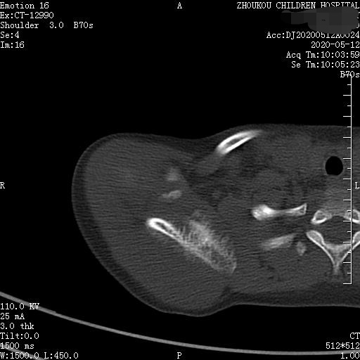 家长要警惕孩子腺样体面容,家长应该警惕孩子出现异常