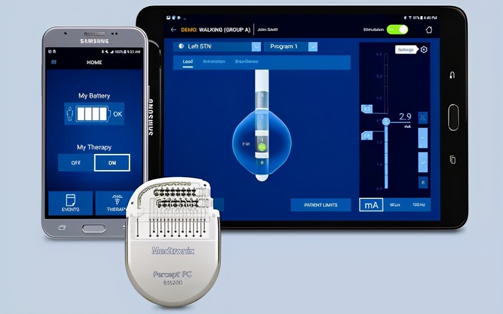 神经调控技术发展前景,神经调控前沿疗法