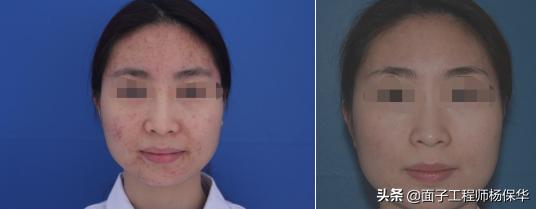 皮肤医生谈面霜,皮肤医生谈美白淡斑