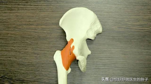 髋关节疼痛会引起腿痛吗,髋关节疼痛两腿不一样长如何康复