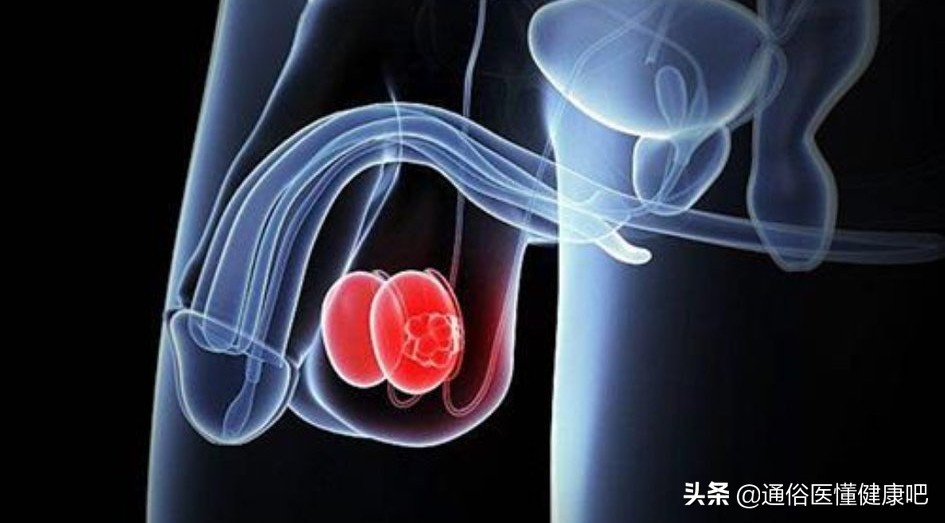 “蛋蛋”变硬？15~35岁男性最需注意的癌变预兆