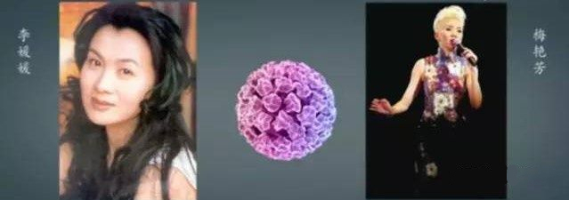 预防宫颈癌和乳腺癌的疫苗,预防乳腺癌宫颈癌的预防针多少钱