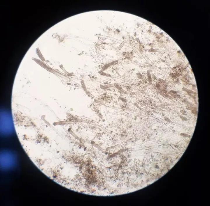 金鱼低温水霉病怎么治,低温水霉病怎么治