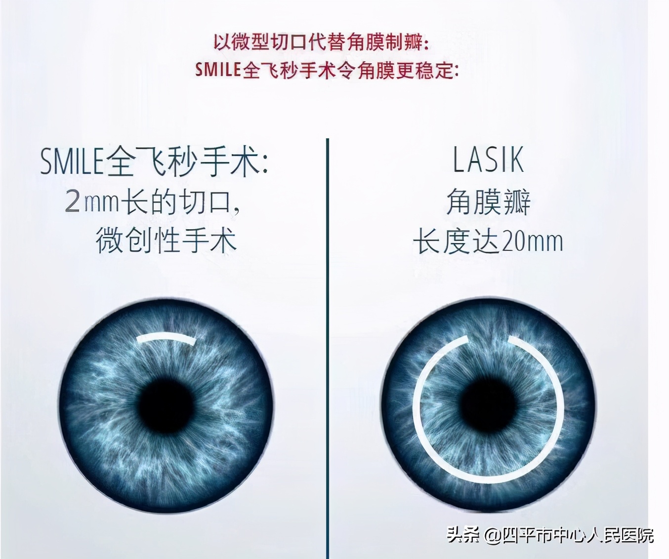 普通公务员视力要求达不到怎么办,近视眼公务员体检能过吗