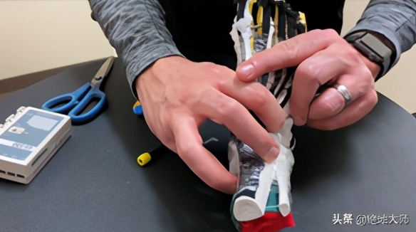 足踝活动受限康复训练视频,足踝功能恢复训练