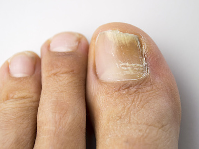 效果好又便宜常用药膏,几款管用的小药膏