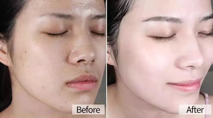 抖音上爆火去螨虫黑头的洗面奶,全网很火男生洗面奶