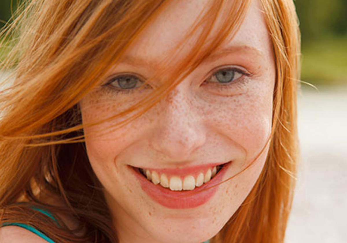 脸上有斑和手上有斑怎么回事,怎样知道自己脸上的斑是哪种斑