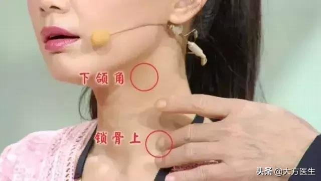 甲状腺疾病是碘不够还是摄入过量,甲状腺疾病的高发与加碘盐有关吗