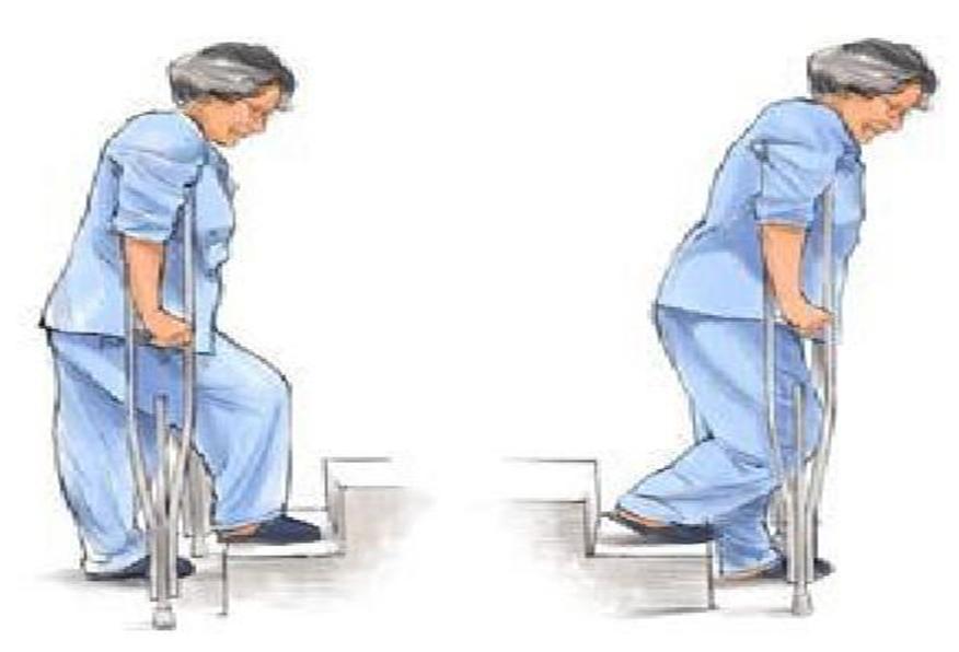 髋关节置换后多久能下床走路,髋关节置换后多久能下地负重