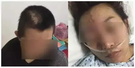 外面小作坊整容“车祸”太闹心,深圳公立医院请来英国最牛“外貌协会”