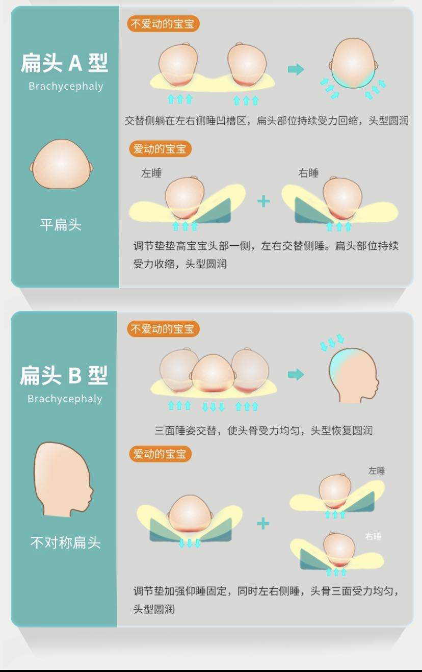 头越睡越扁是什么原因,孩子头睡扁了还能圆吗