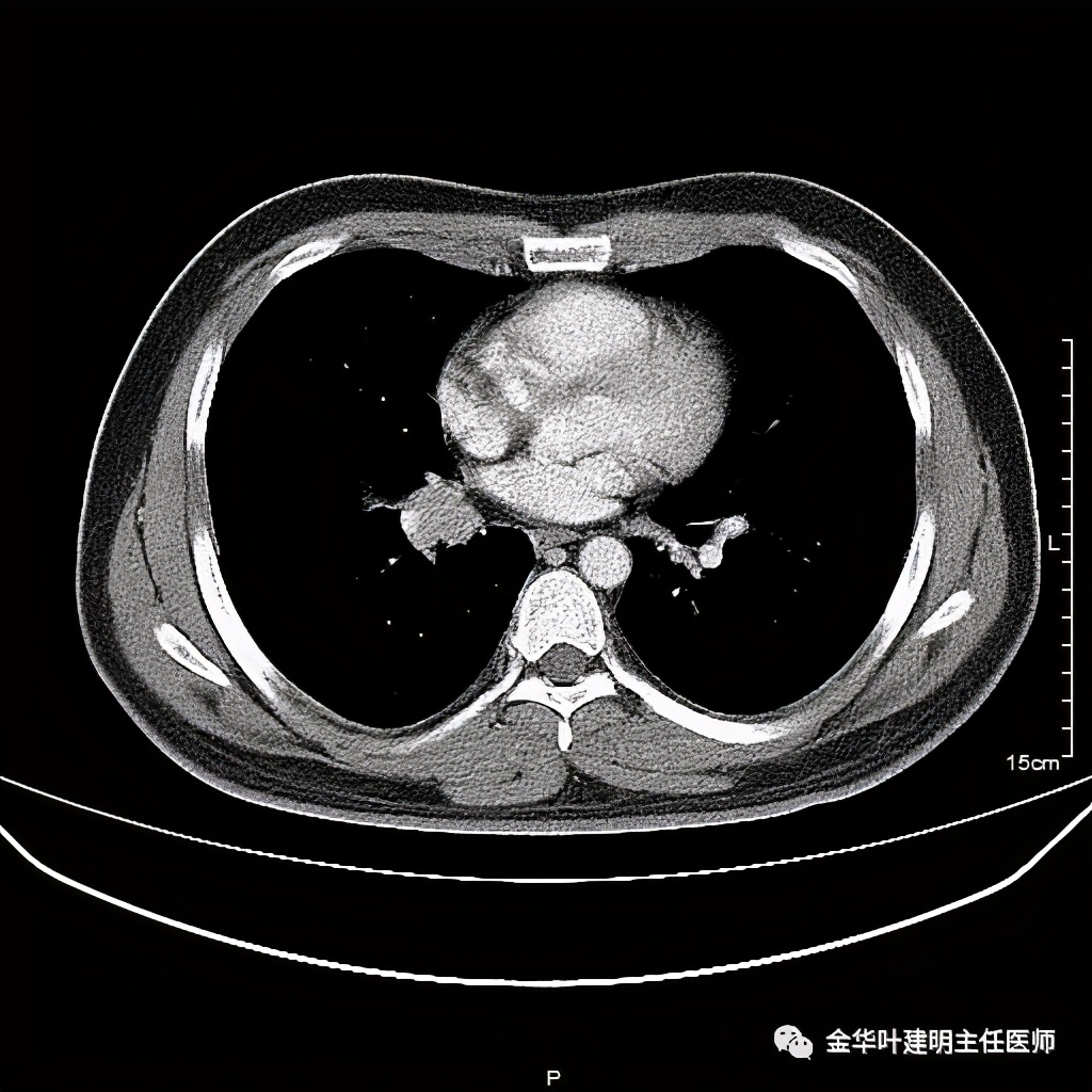 放个大招完整版教学,放个大招完整版前奏