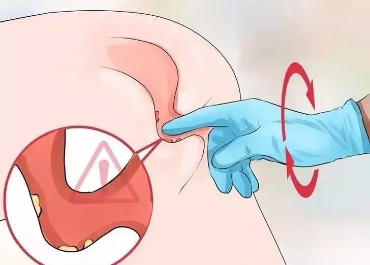 前列腺增生怎么改善或者预防,年轻人前列腺结石的预防方法