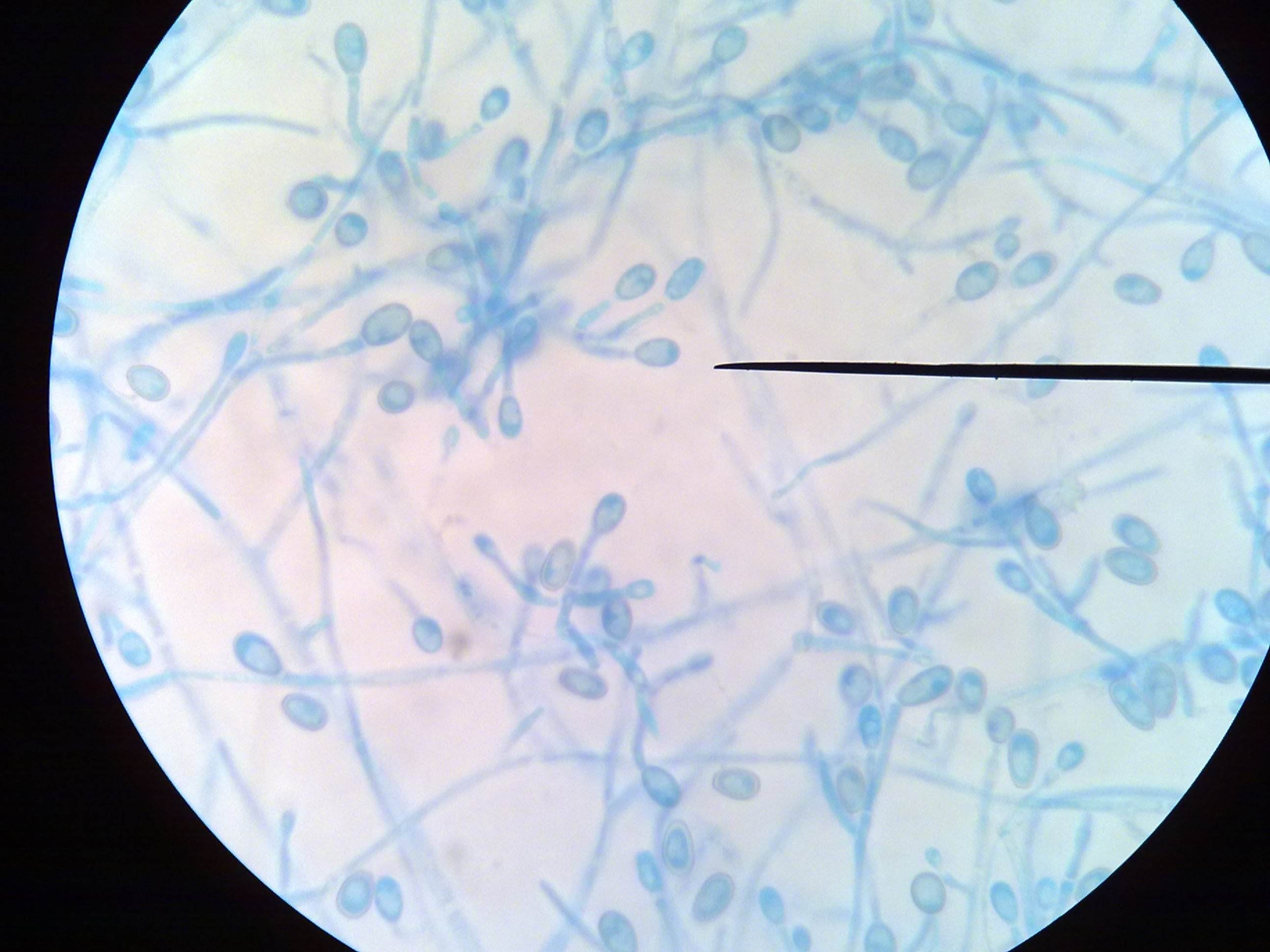 你对脚气、皮癣的致病菌了解多少?