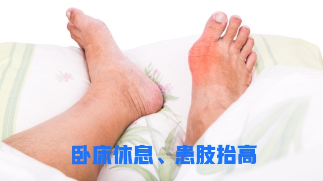 治痛风最便宜的消炎药有哪些,痛风急性发作吃止疼药没效果