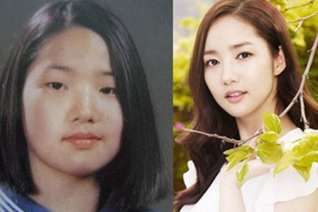 韩式整容怎么样,韩式整形对比