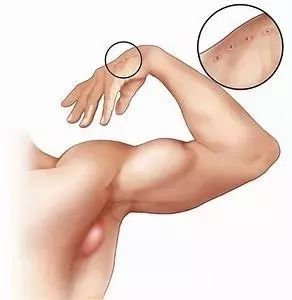 养猫得真菌头癣辟谣,养猫辟谣