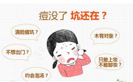 祛痘印最有效的方法洗面奶,祛痘印最有效的方法老爸评测