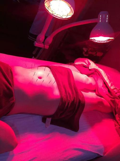 产后埋线减肥的效果怎么样,埋线减肥视频全过程