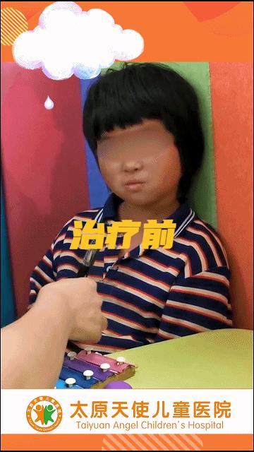 思维发育迟缓治疗方法,儿童语言发育迟缓不开口说话启示