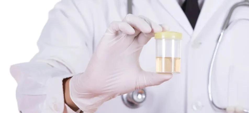 尿频尿急尿痛的不良后果,尿频尿急尿痛疑难杂症