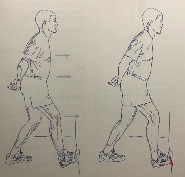 踝关节体态评估,体态评估如何评估踝关节内外翻